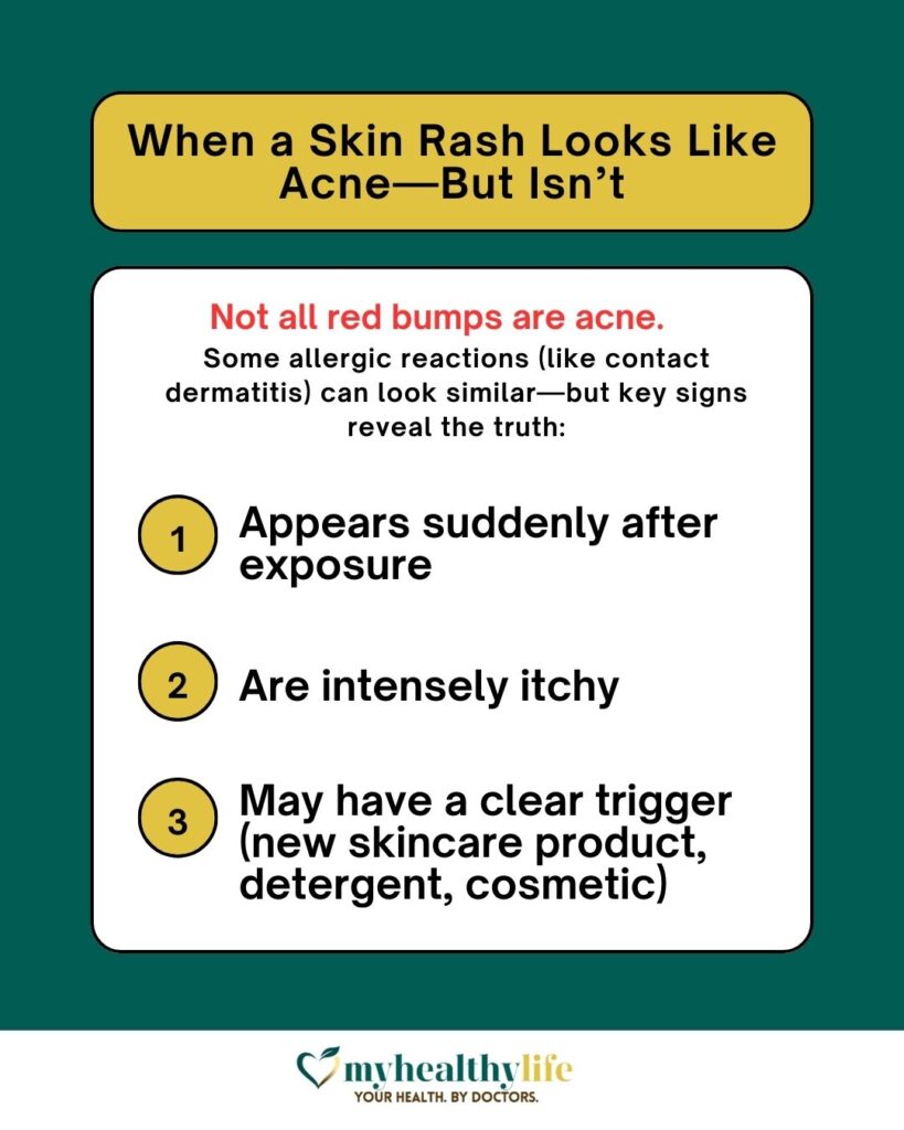 Hormonal Acne vs Allergic Reactions: Key Differences